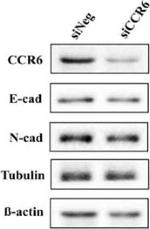 Mouse IgG (H+L) Secondary Antibody in Western Blot (WB)