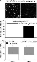 Rabbit IgG (H+L) Secondary Antibody in Immunocytochemistry (ICC/IF)