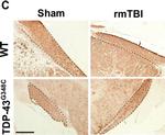 Rabbit IgG (H+L) Secondary Antibody in Immunohistochemistry (IHC)