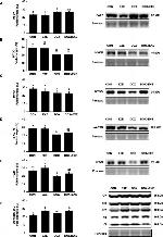 Goat IgG (H+L) Secondary Antibody in Western Blot (WB)