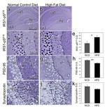 Phospho-IRS1 (Ser616) Antibody in Immunohistochemistry, Immunohistochemistry (Paraffin) (IHC, IHC (P))