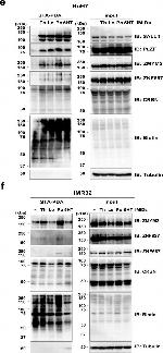 Goat IgG (H+L) Secondary Antibody in Western Blot (WB)