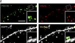 Guinea Pig IgG (H+L) Highly Cross-Adsorbed Secondary Antibody in Immunocytochemistry (ICC/IF)