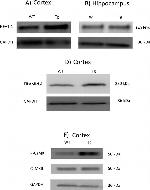 Rabbit IgG (H+L) Highly Cross-Adsorbed Secondary Antibody in Western Blot (WB)