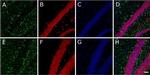 Mouse IgG (H+L) Cross-Adsorbed Secondary Antibody in Immunohistochemistry (Frozen) (IHC (F))