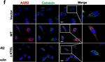 Mouse IgG (H+L) Cross-Adsorbed Secondary Antibody in Immunocytochemistry (ICC/IF)