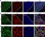 Rabbit IgG (H+L) Highly Cross-Adsorbed Secondary Antibody in Immunohistochemistry (IHC)