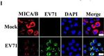 Rabbit IgG (H+L) Highly Cross-Adsorbed Secondary Antibody in Immunocytochemistry (ICC/IF)