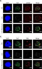 Mouse IgG (H+L) Cross-Adsorbed Secondary Antibody in Immunocytochemistry (ICC/IF)