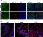 Mouse IgG (H+L) Highly Cross-Adsorbed Secondary Antibody in Immunohistochemistry (IHC)