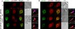 Rat IgG (H+L) Cross-Adsorbed Secondary Antibody in Immunocytochemistry (ICC/IF)