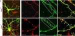 Rat IgG (H+L) Cross-Adsorbed Secondary Antibody in Immunocytochemistry (ICC/IF)