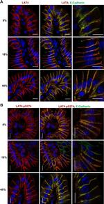 Rat IgG (H+L) Cross-Adsorbed Secondary Antibody in Immunohistochemistry (IHC)