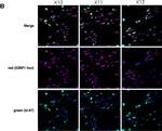 Rat IgG (H+L) Cross-Adsorbed Secondary Antibody in Immunocytochemistry (ICC/IF)