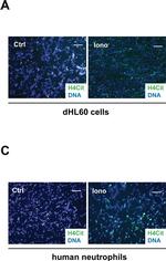 Rabbit IgG (H+L) Cross-Adsorbed Secondary Antibody in Immunocytochemistry (ICC/IF)