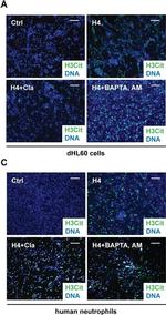 Rabbit IgG (H+L) Cross-Adsorbed Secondary Antibody in Immunocytochemistry (ICC/IF)