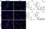 Mouse IgG1 Cross-Adsorbed Secondary Antibody in Immunohistochemistry (IHC)
