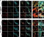 Mouse IgG (H+L) Highly Cross-Adsorbed Secondary Antibody in Immunocytochemistry (ICC/IF)