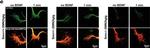 Mouse IgG (H+L) Highly Cross-Adsorbed Secondary Antibody in Immunocytochemistry (ICC/IF)