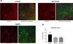 Rabbit IgG (H+L) Cross-Adsorbed Secondary Antibody in Immunohistochemistry (IHC)