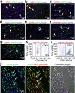 CD34 Antibody in Immunohistochemistry (IHC)