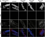 Rabbit IgG (H+L) Cross-Adsorbed Secondary Antibody in Immunocytochemistry (ICC/IF)