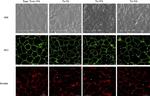 Rabbit IgG (H+L) Cross-Adsorbed Secondary Antibody in Immunocytochemistry (ICC/IF)