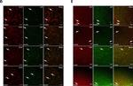 Chicken IgY (H+L) Secondary Antibody in Immunohistochemistry (IHC)