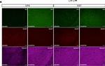 Mouse IgG (H+L) Highly Cross-Adsorbed Secondary Antibody in Immunohistochemistry (IHC)