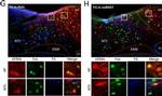 Sheep IgG (H+L) Cross-Adsorbed Secondary Antibody in Immunohistochemistry (IHC)