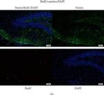 Mouse IgG (H+L) Highly Cross-Adsorbed Secondary Antibody in Immunohistochemistry (Paraffin) (IHC (P))