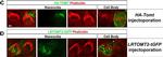 Rabbit IgG (H+L) Cross-Adsorbed Secondary Antibody in Immunocytochemistry (ICC/IF)