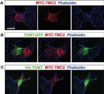 Mouse IgG (H+L) Cross-Adsorbed Secondary Antibody in Immunocytochemistry (ICC/IF)