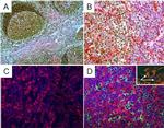 Mouse IgG (H+L) Cross-Adsorbed Secondary Antibody in Immunohistochemistry (Paraffin) (IHC (P))