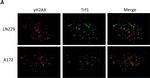 Mouse IgG (H+L) Cross-Adsorbed Secondary Antibody in Immunohistochemistry (IHC)