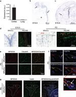 CD140b (PDGFRB) Antibody in Immunohistochemistry (IHC)