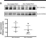 Rabbit IgG (H+L) Secondary Antibody in Western Blot (WB)