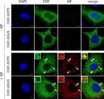 Rabbit IgG (H+L) Highly Cross-Adsorbed Secondary Antibody in Immunocytochemistry (ICC/IF)