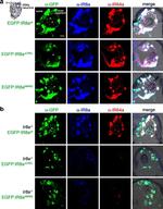 Mouse IgG (H+L) Highly Cross-Adsorbed Secondary Antibody in Immunohistochemistry (IHC)