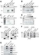 ZO-2 Antibody in Western Blot (WB)