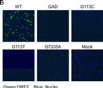 Mouse IgG (H+L) Highly Cross-Adsorbed Secondary Antibody in Immunocytochemistry (ICC/IF)