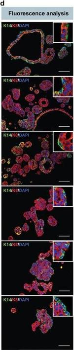 Mouse IgG (H+L) Highly Cross-Adsorbed Secondary Antibody in Immunohistochemistry (Paraffin) (IHC (P))