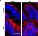 Mouse IgG (H+L) Highly Cross-Adsorbed Secondary Antibody in Immunocytochemistry (ICC/IF)