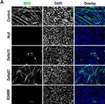 Rabbit IgG (H+L) Highly Cross-Adsorbed Secondary Antibody in Immunocytochemistry (ICC/IF)