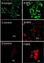 Rabbit IgG (H+L) Highly Cross-Adsorbed Secondary Antibody in Immunocytochemistry (ICC/IF)