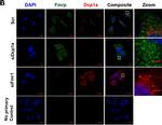 Rabbit IgG (H+L) Highly Cross-Adsorbed Secondary Antibody in Immunocytochemistry (ICC/IF)