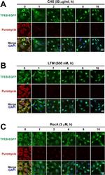 Rabbit IgG (H+L) Highly Cross-Adsorbed Secondary Antibody in Immunocytochemistry (ICC/IF)