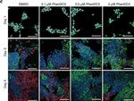 Rabbit IgG (H+L) Highly Cross-Adsorbed Secondary Antibody in Immunocytochemistry (ICC/IF)