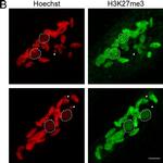 Rabbit IgG (H+L) Highly Cross-Adsorbed Secondary Antibody in Immunocytochemistry (ICC/IF)