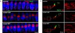 Mouse IgG1 Cross-Adsorbed Secondary Antibody in Immunohistochemistry (IHC)